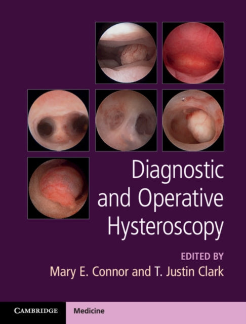 Diagnostic & Operative Hysteroscopy