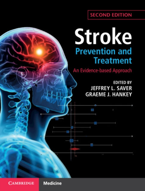 Stroke Prevention & Treatment