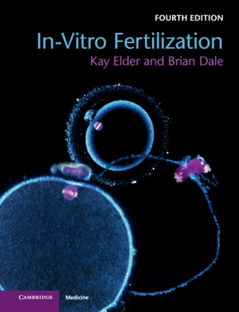 Invitro Fertilization