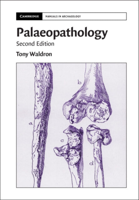 Palaeopathology By Waldron, Tony