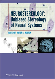 Neurostereology Unbiased Stereology Of