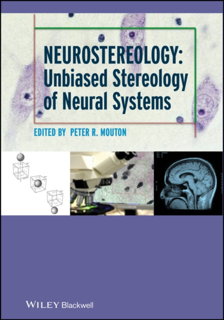 Neurostereology Unbiased Stereology Of