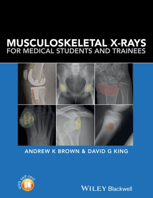Musculoskeletal Xrays For Medical Studen