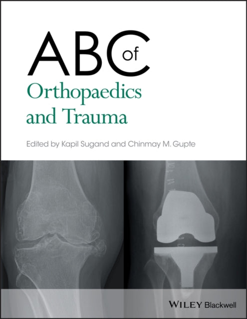 Abc Of Orthopaedics & Trauma