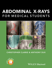 Abdominal Xrays For Medical Students