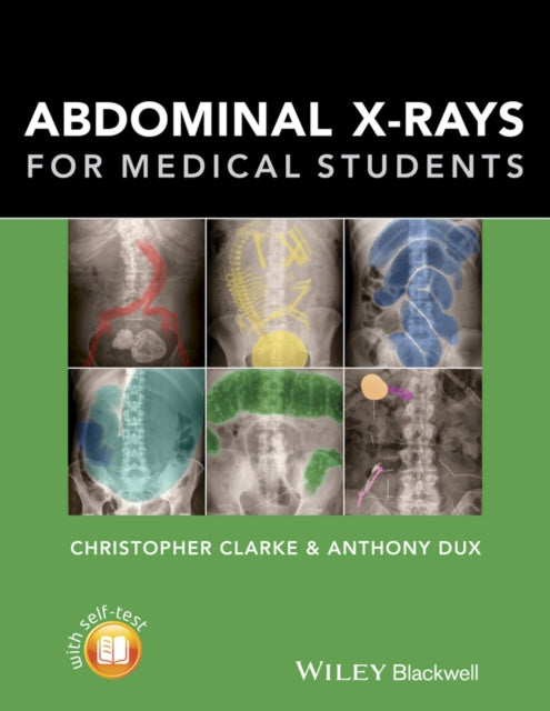 Abdominal Xrays For Medical Students
