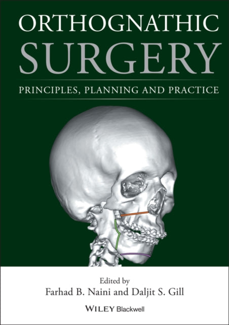 Orthognathic Surgery Principles Planni