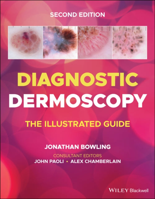 Diagnostic Dermoscopy The Illus