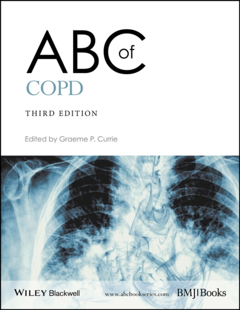 Abc Of Copd 3e