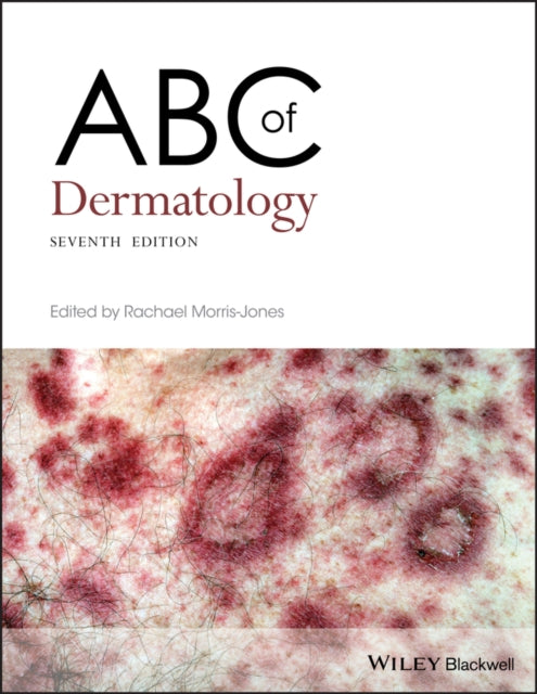 Abc Of Dermatology