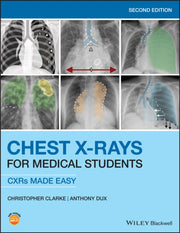 Chest Xrays For Medical Students 2nd Edi