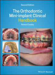 Orthodontic Miniimplant Clinical Handboo