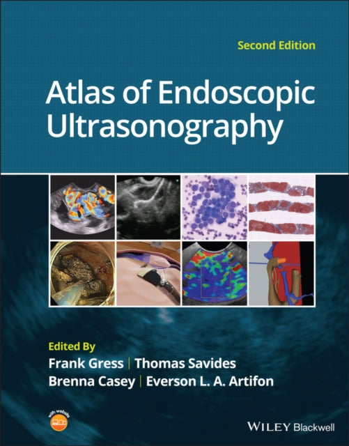 Atlas Of Endoscopic Ultrasonography By Fg Gress