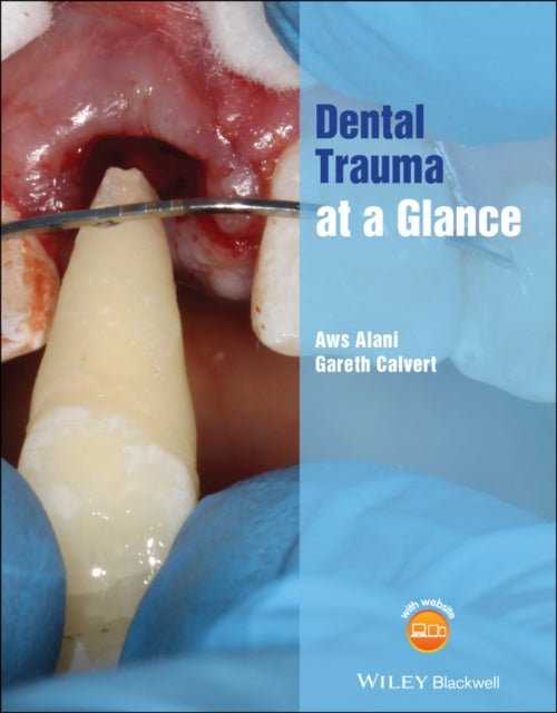 Dental Trauma At A Glance