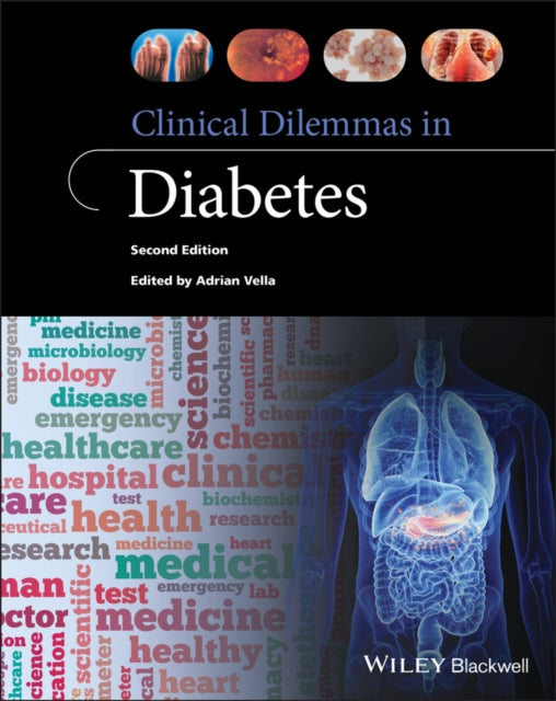 Clinical Dilemmas In Diabetes 2nd Editio