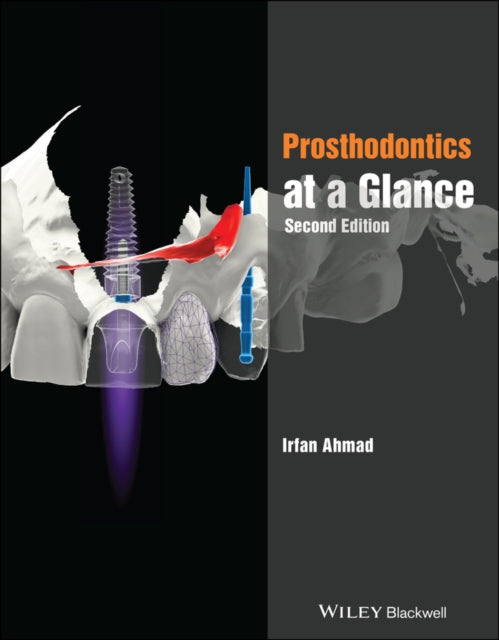 Prosthodontics At A Glance