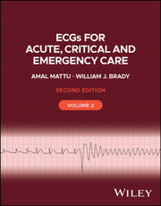 Ecgs For Acute Critical And Emergency