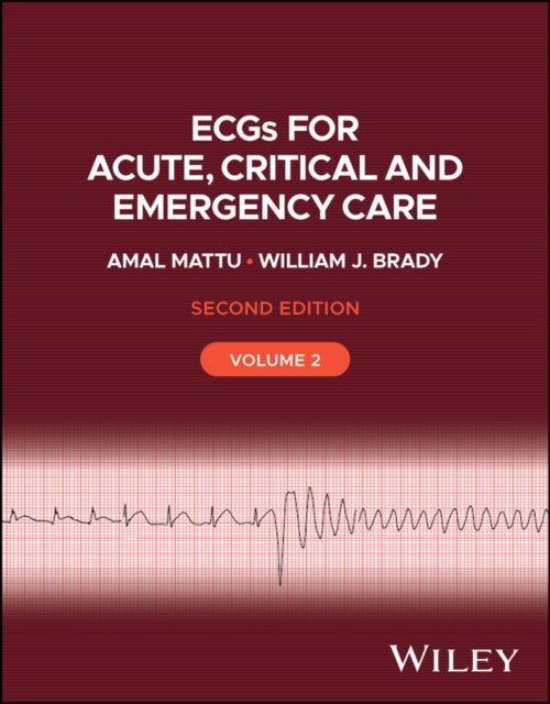 Ecgs For Acute Critical And Emergency
