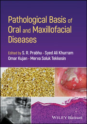 Pathological Basis Of Oral And Maxillof