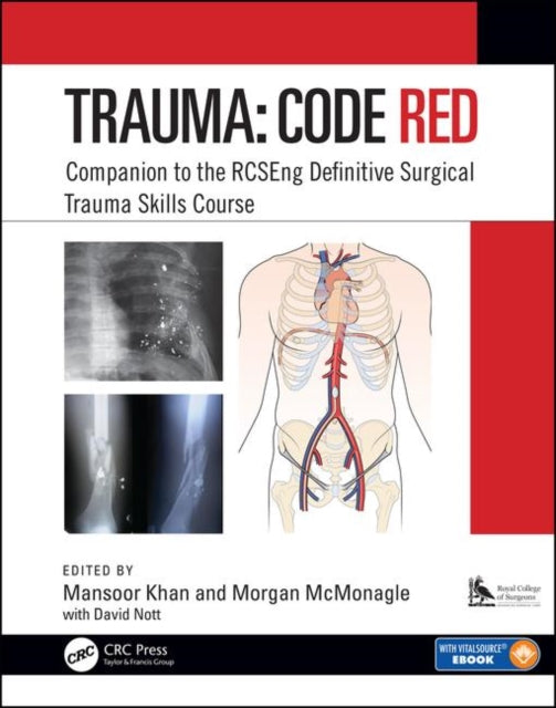 Trauma Code Red