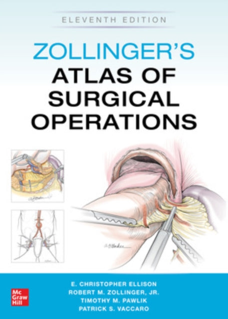 Zollingers Atlas Of Surgical Operations By Zollinger