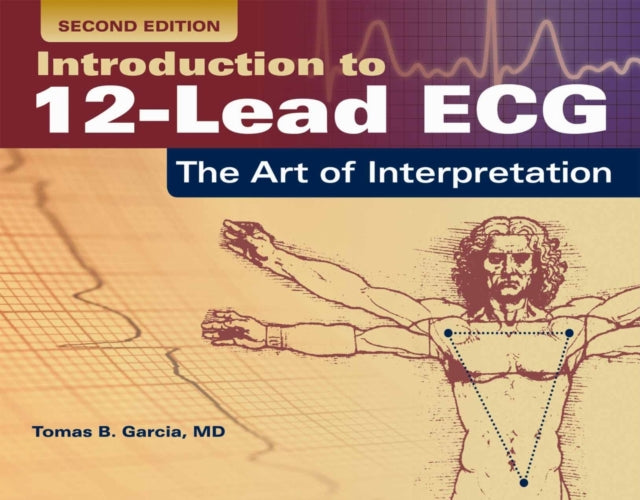Intro To 12 Lead Ecg 2e