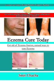 Eczema Cure Today - Get Rid Of Eczema Fo By Chacha, Smit