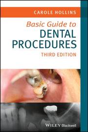 Basic Guide To Dental Procedures 3rd E