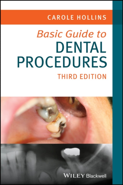 Basic Guide To Dental Procedures 3rd E