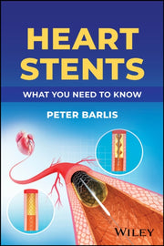 Understanding Heart Stents A Guide For