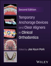 Temporary Anchorage Devices And Clear A
