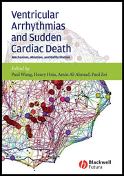 Ventricular Arrhythmias And Sudden Card By Wang