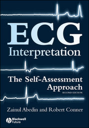 Ecg Interpretation The Self Assessment