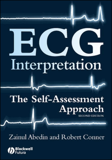 Ecg Interpretation The Self Assessment