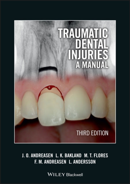 Traumatic Dental Injuries A Manual 3rd E