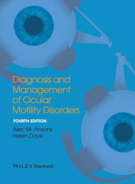Diagnosis & Management Of Ocular Motilit