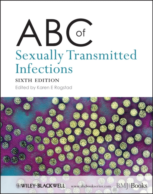 Abc Of Sexually Transmitted Infections By Rogstad, Karen