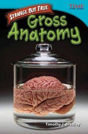 Strange But True: Gross Anatomy : Gross