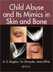 Child Abuse & Its Mimics In Skin & Bone