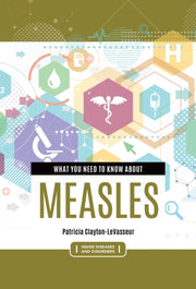 What You Need To Know About Measles