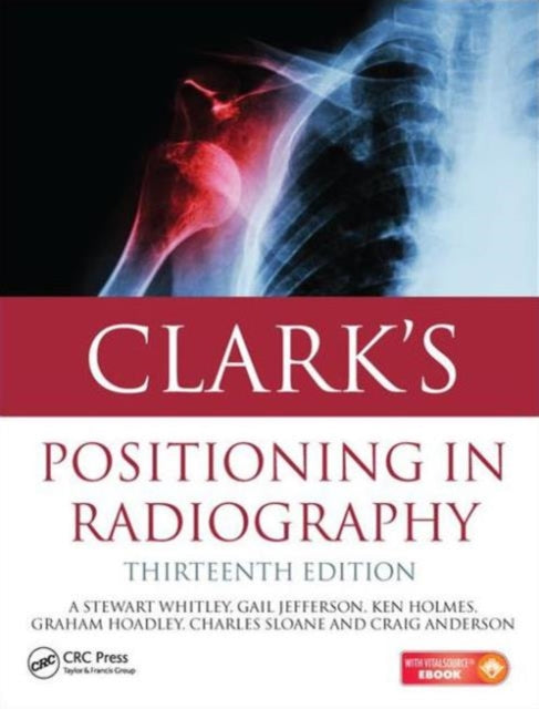 Clarks Positioning In Radiography