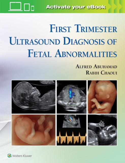 Atlas Ultrasound Anat First Trimester