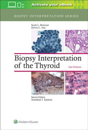 Biopsy Interpretation Of The Thyroid Bio By Boerner, Scott, L.