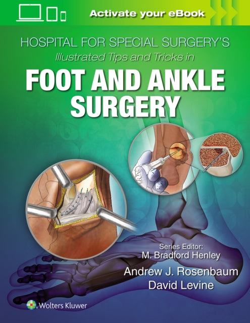 Hospital For Special Surgerys Illustrate