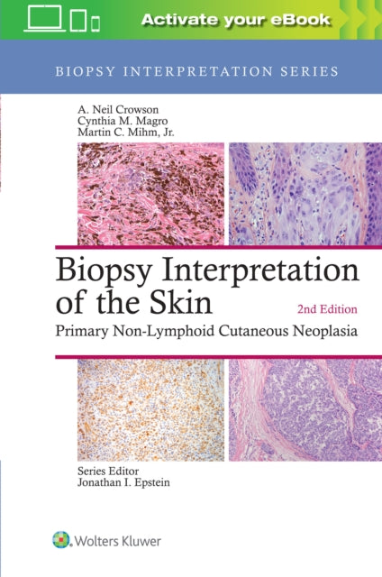 Biopsy Interpretation Of The Skin Biopsy
