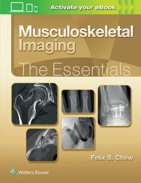 Musculoskeletal Imaging The Essentials