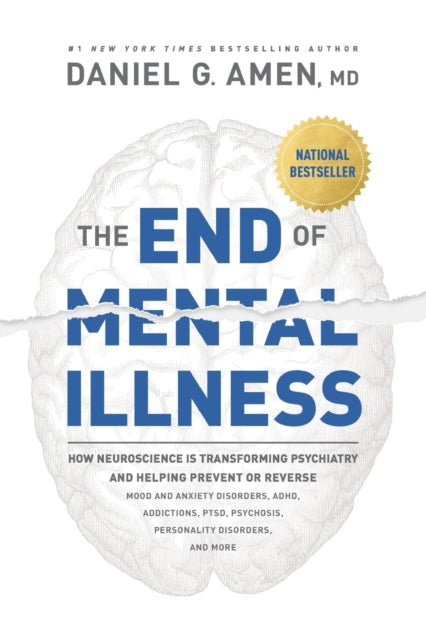 End Of Mental Illness