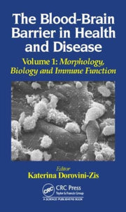 Bloodbrain Barrier In Health & Disease By Dorovini-zis, Kateri