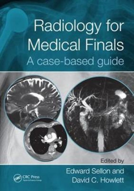 Radiology For Medical Finals
