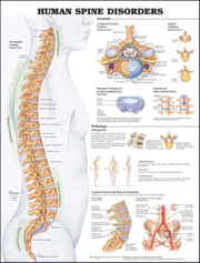 Human Spine Disorders 2e Laminated